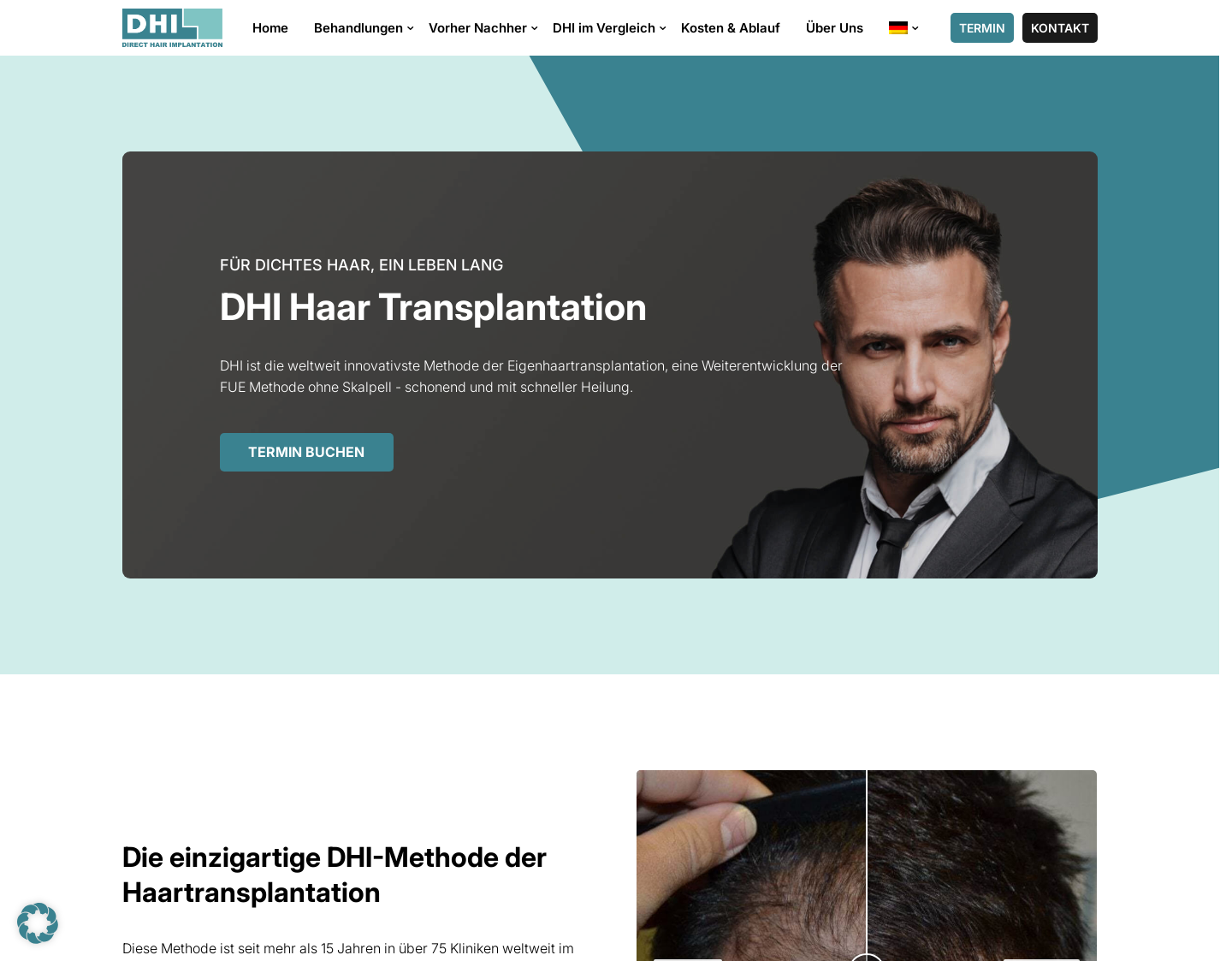 Aktuelle Website-Vorschau von DHI Vienna - Direct Hair Implantation